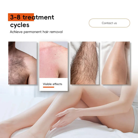 Laser Hair Removal Machine: The Best Choice for Permanent Hair Reduction ✨