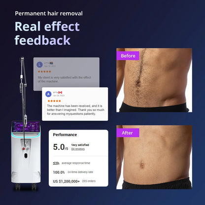 BMLASER 2025 Alexandrite 755nm GentleMax Laser Hair Removal Machine – Permanent, Pain-Free Professional Beauty Equipment
