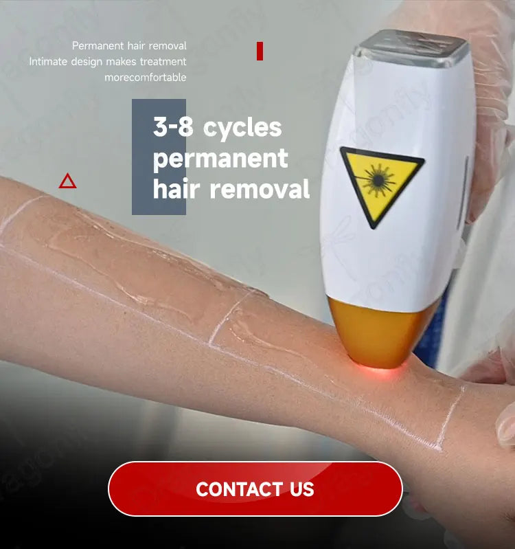 2025  4-Wave Diode Laser Hair Removal Machine | 600–2000W Power, 755+808+940+1064nm, Permanent Epilation with TEC Cooling
