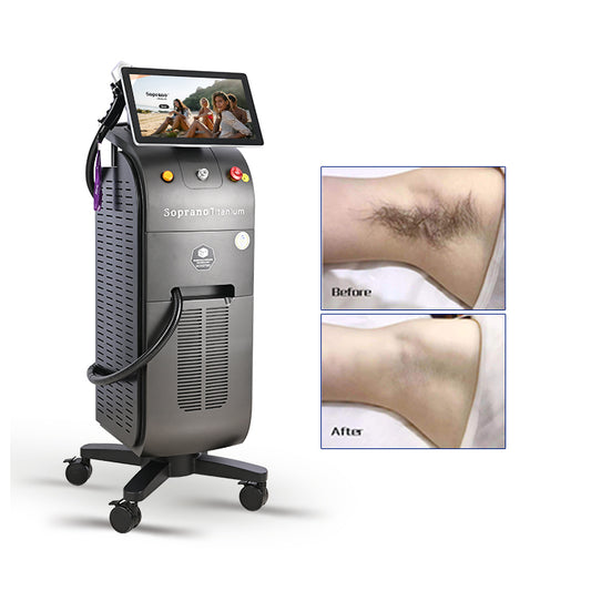 2022 Two-year Warranty Soprano Ice Titanium 755 808 1064nm Laser 1600W Diode Laser Hair Removal Beauty Machine Newest 3Wave