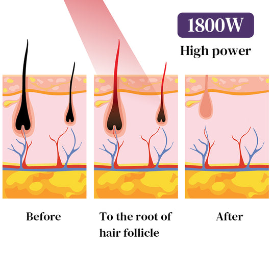 2025 Hot Ice Titanium Diode Laser Hair Removal Machine | Dual or Single Head | CE TUV ISO Certified | 1600–2000W | 4 Wavelengths 755/808/940/1064nm