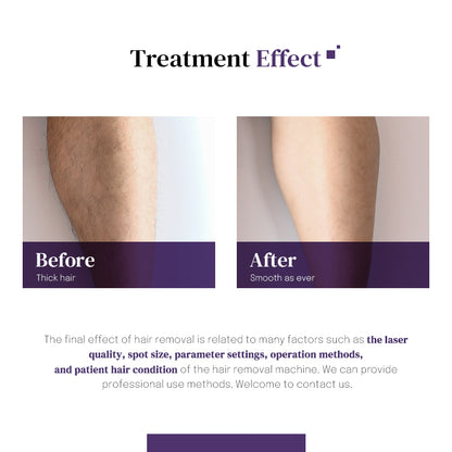 2025 Hot Ice Titanium Diode Laser Hair Removal Machine | Dual or Single Head | CE TUV ISO Certified | 1600–2000W | 4 Wavelengths 755/808/940/1064nm